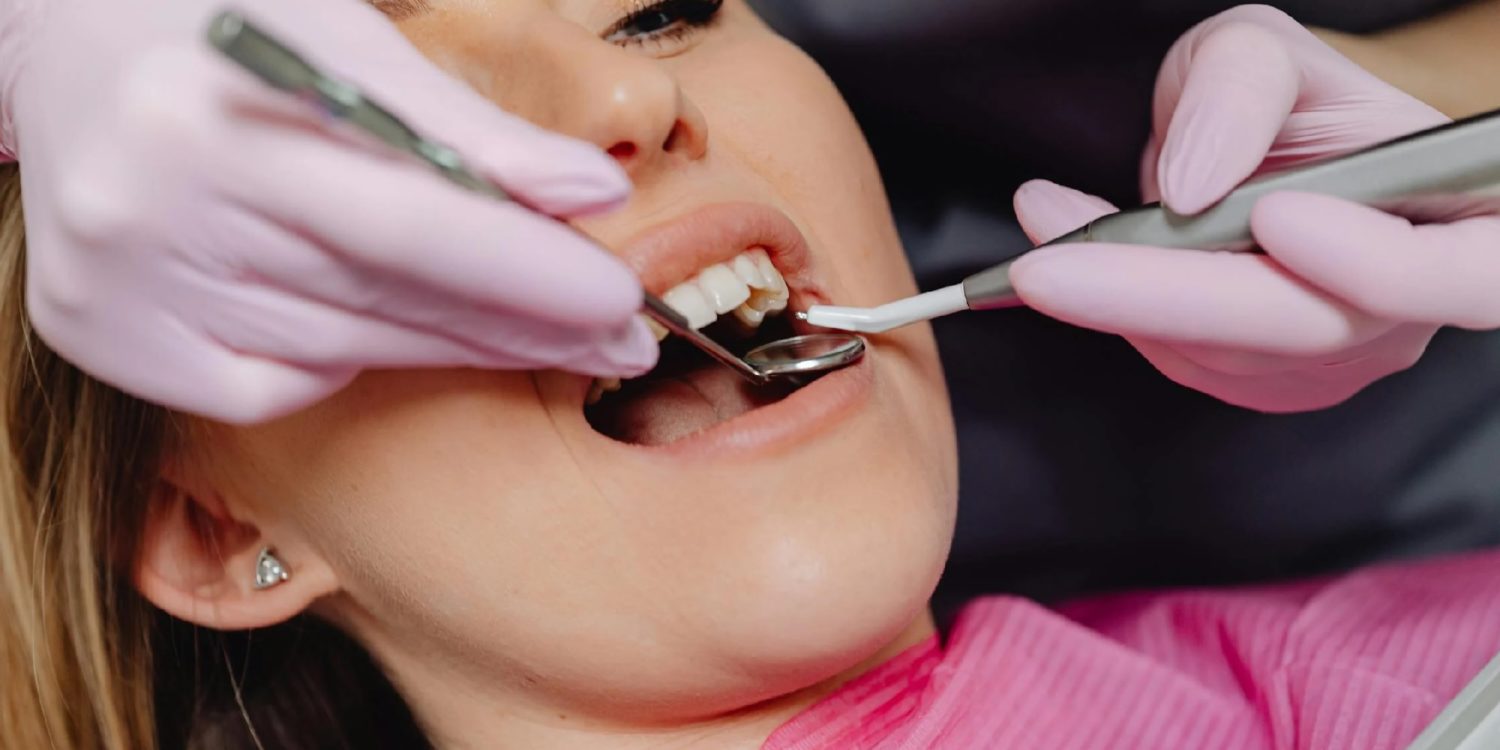 Comment traiter le déchaussement dentaire efficacement ?