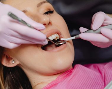Comment traiter le déchaussement dentaire efficacement ?