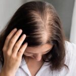 Comprendre la perte de densité capillaire chez la femme : causes, signes et premiers réflexes Femme écartant ses cheveux pour montrer une raie plus visible sur le sommet du crâne